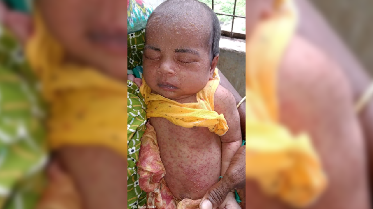 ছবি: প্রতিনিধি